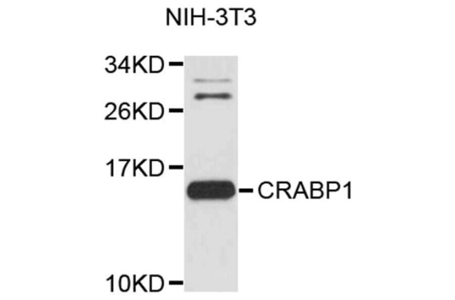 Western Blot - Anti-CRABP1 Antibody (A8838) - Antibodies.com