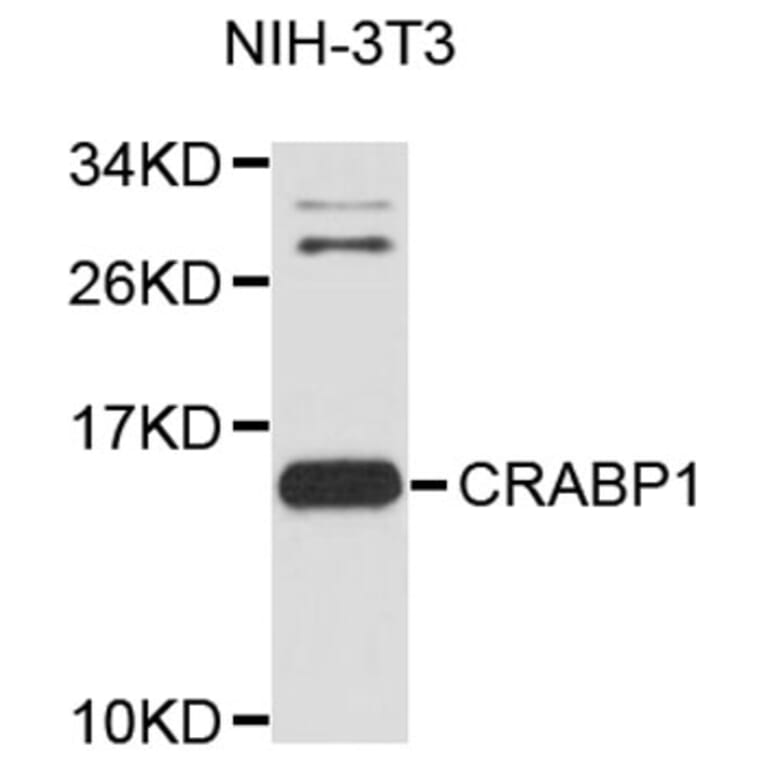 Western Blot - Anti-CRABP1 Antibody (A8838) - Antibodies.com