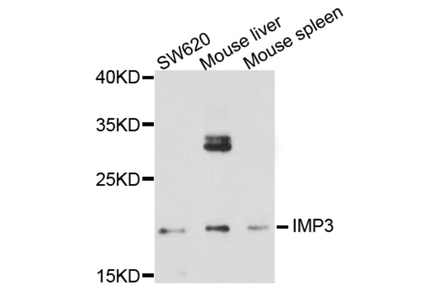 Western Blot - Anti-IMP3 Antibody (A8855) - Antibodies.com