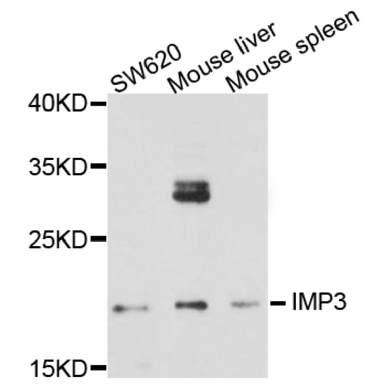 Western Blot - Anti-IMP3 Antibody (A8855) - Antibodies.com