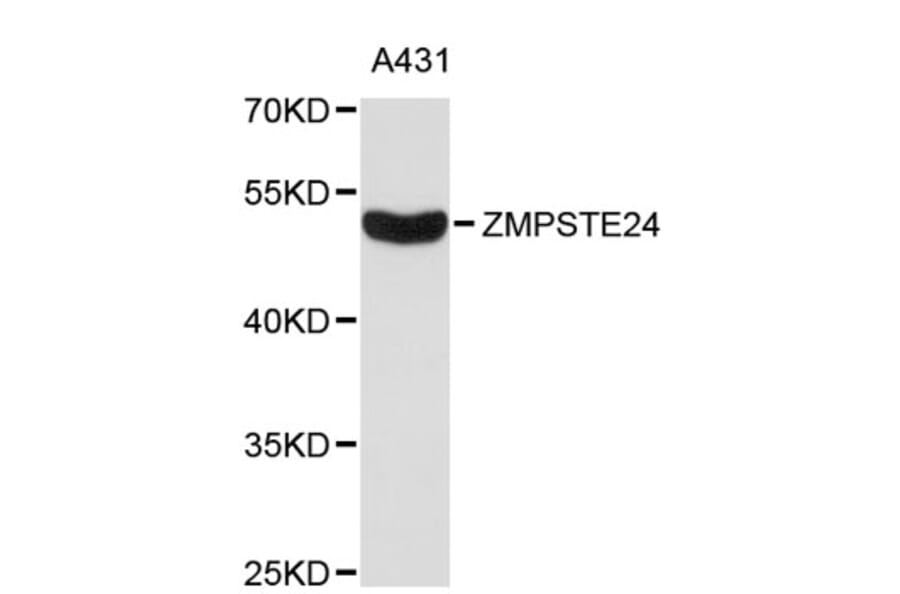 Western Blot - Anti-ZMPSTE24 Antibody (A8858) - Antibodies.com