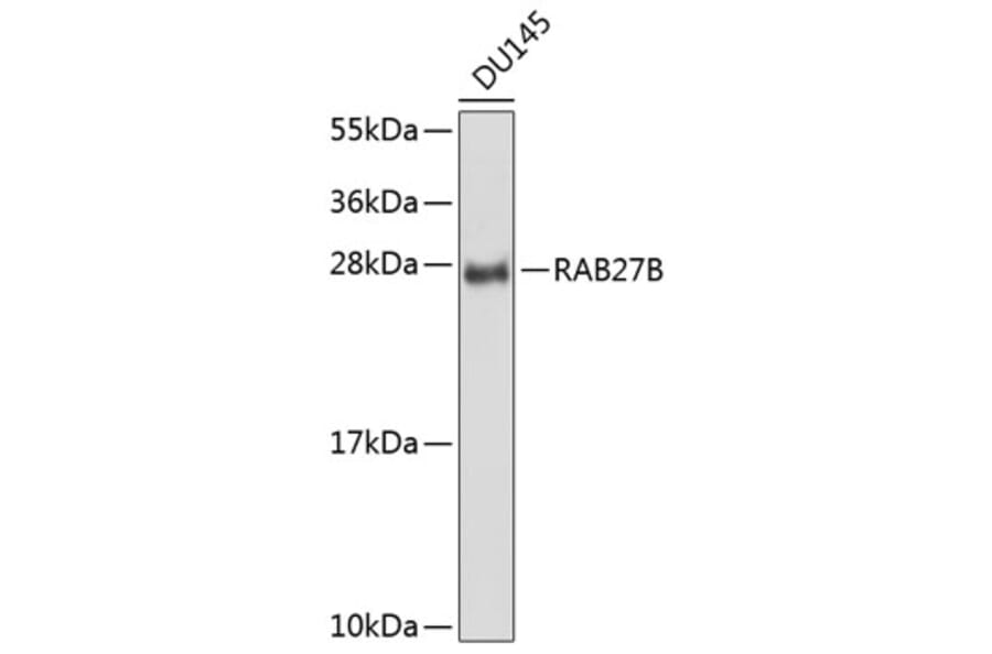 Western Blot - Anti-RAB27B Antibody (A8897) - Antibodies.com