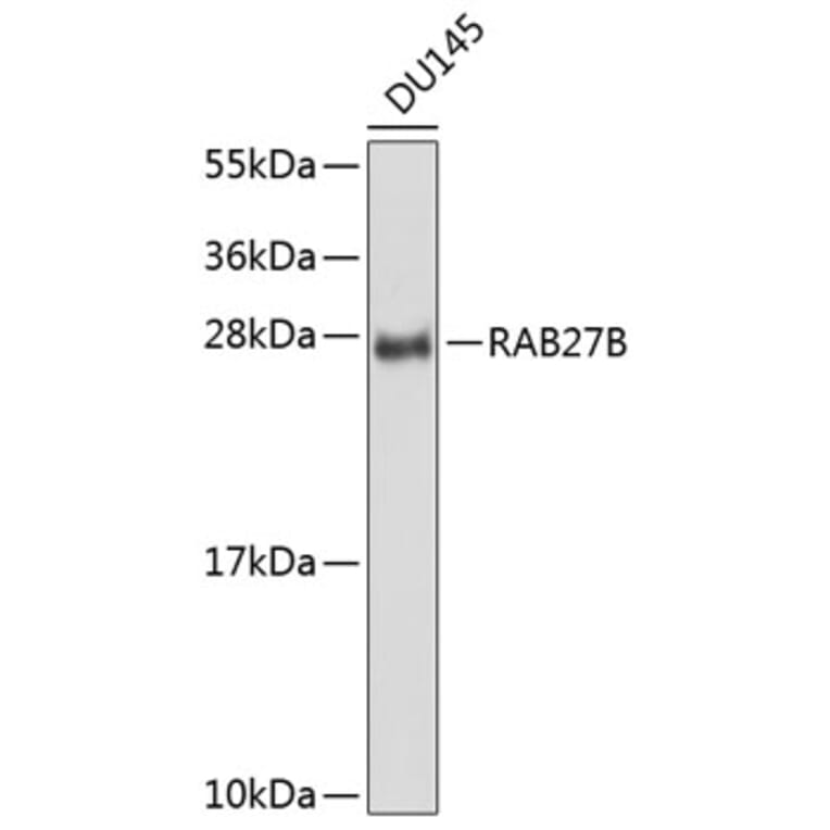 Western Blot - Anti-RAB27B Antibody (A8897) - Antibodies.com