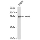 Western Blot - Anti-RAB27B Antibody (A8897) - Antibodies.com