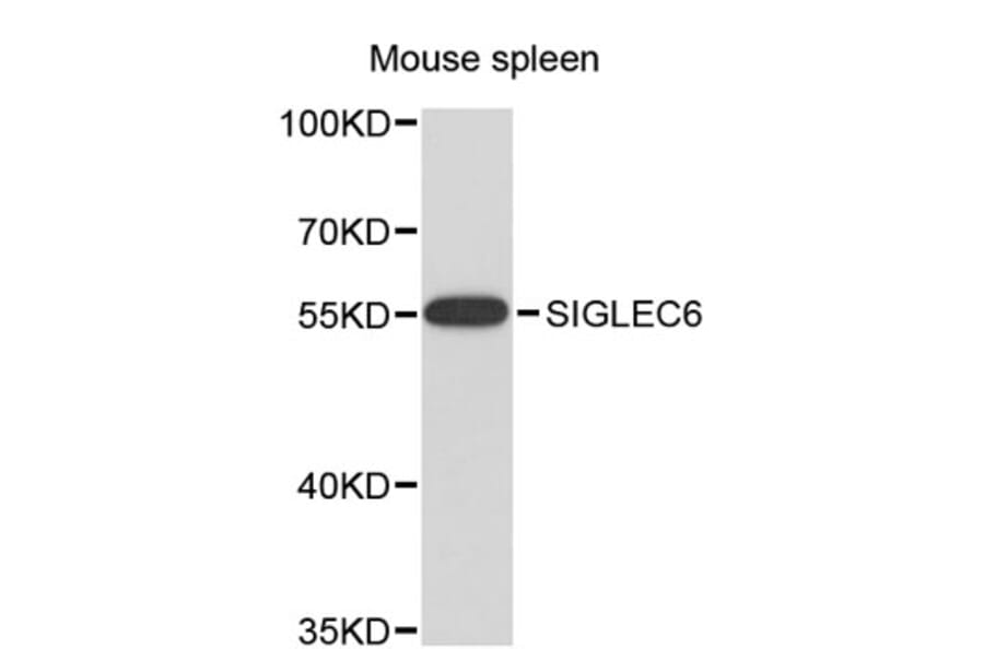 Western Blot - Anti-SIGLEC6 Antibody (A8901) - Antibodies.com