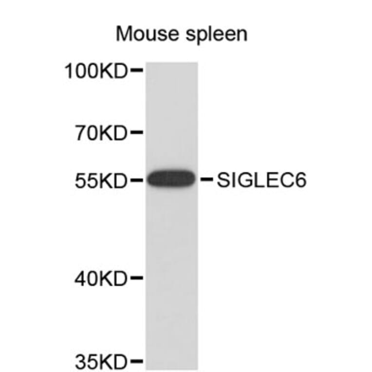 Western Blot - Anti-SIGLEC6 Antibody (A8901) - Antibodies.com