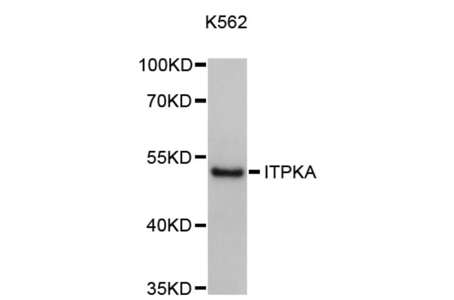 Western Blot - Anti-ITPKA Antibody (A8978) - Antibodies.com