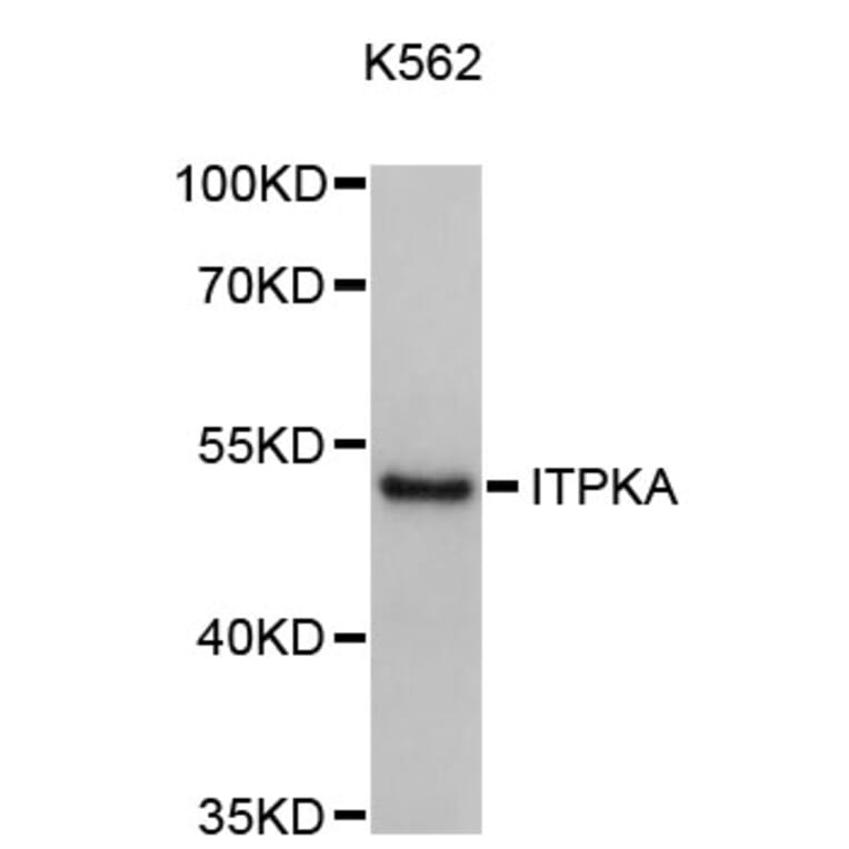 Western Blot - Anti-ITPKA Antibody (A8978) - Antibodies.com