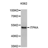 Western Blot - Anti-ITPKA Antibody (A8978) - Antibodies.com