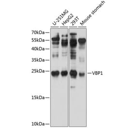 Western Blot - Anti-VBP-1 Antibody (A12323) - Antibodies.com