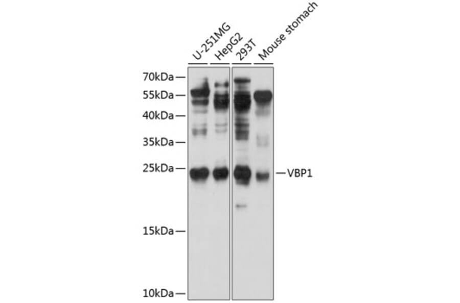 Western Blot - Anti-VBP-1 Antibody (A12323) - Antibodies.com