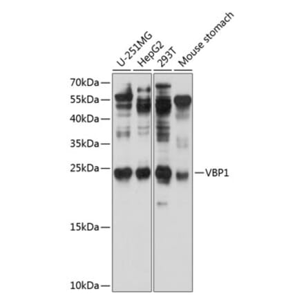 Western Blot - Anti-VBP-1 Antibody (A12323) - Antibodies.com