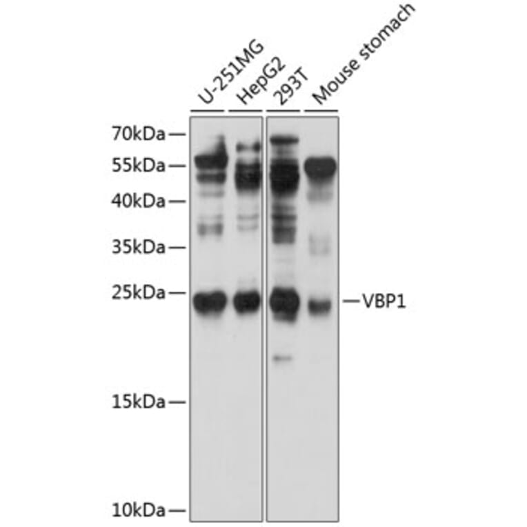 Western Blot - Anti-VBP-1 Antibody (A12323) - Antibodies.com