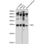 Western Blot - Anti-VBP-1 Antibody (A12323) - Antibodies.com