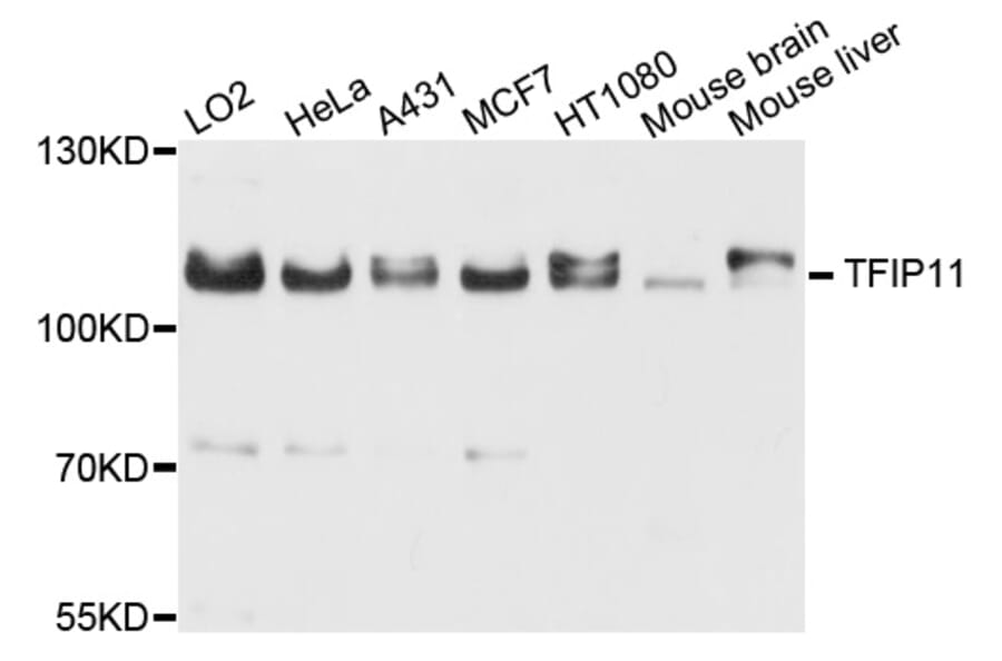 Western Blot - Anti-TFIP11 Antibody (A9000) - Antibodies.com