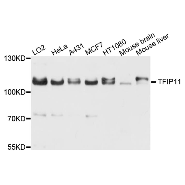 Western Blot - Anti-TFIP11 Antibody (A9000) - Antibodies.com