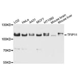 Western Blot - Anti-TFIP11 Antibody (A9000) - Antibodies.com
