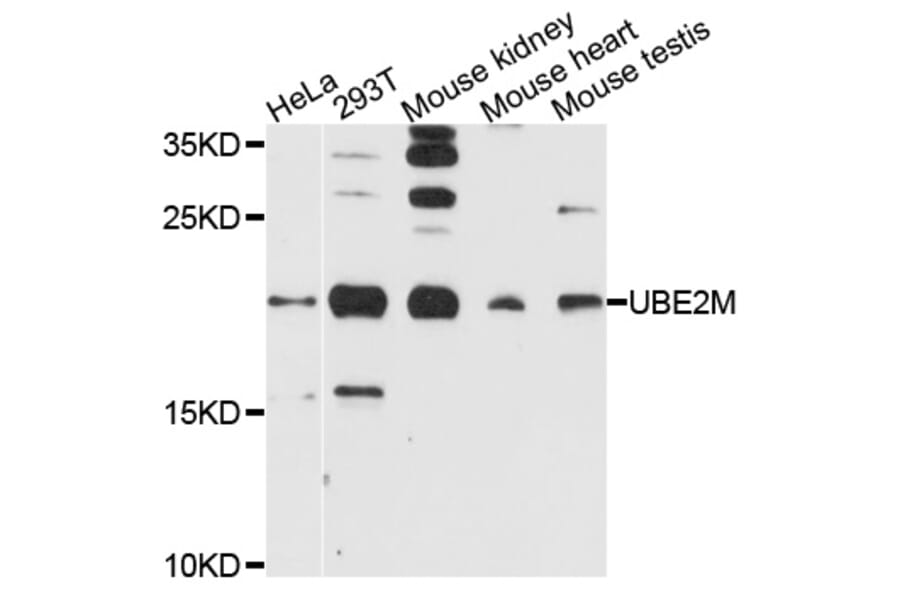 Western Blot - Anti-UBE2M Antibody (A9007) - Antibodies.com