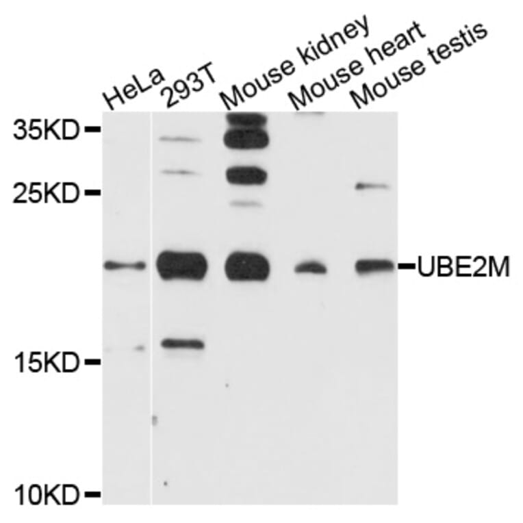 Western Blot - Anti-UBE2M Antibody (A9007) - Antibodies.com