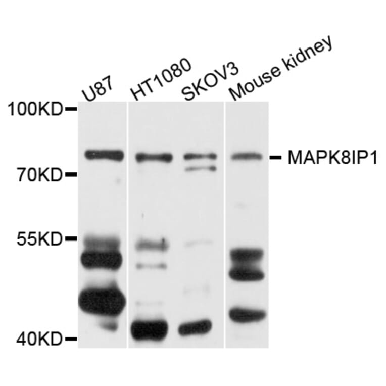 Western Blot - Anti-MAPK8IP1 Antibody (A9011) - Antibodies.com