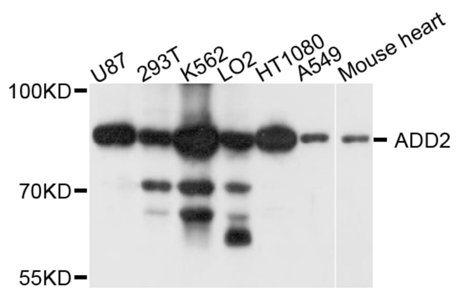 Western Blot - Anti-ADD2 Antibody (A9025) - Antibodies.com