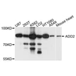 Western Blot - Anti-ADD2 Antibody (A9025) - Antibodies.com