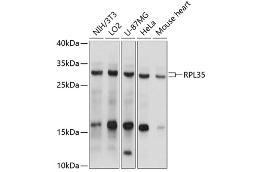 Western Blot - Anti-RPL35 Antibody (A9043) - Antibodies.com