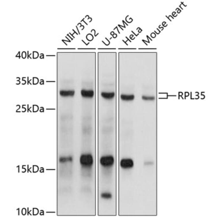 Western Blot - Anti-RPL35 Antibody (A9043) - Antibodies.com