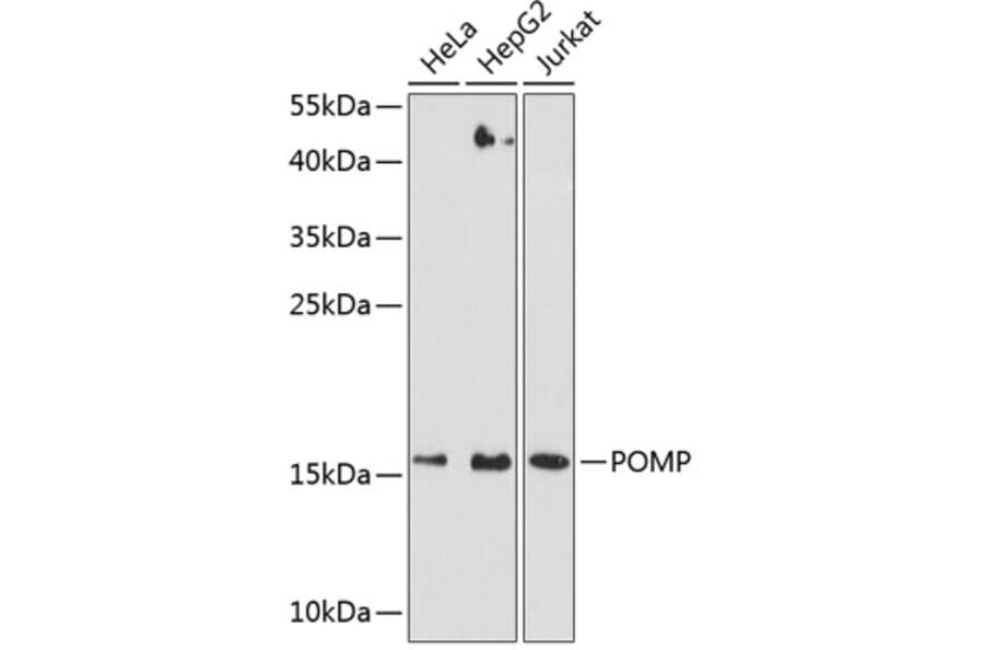 Western Blot - Anti-Proteasome maturation protein Antibody (A12335) - Antibodies.com