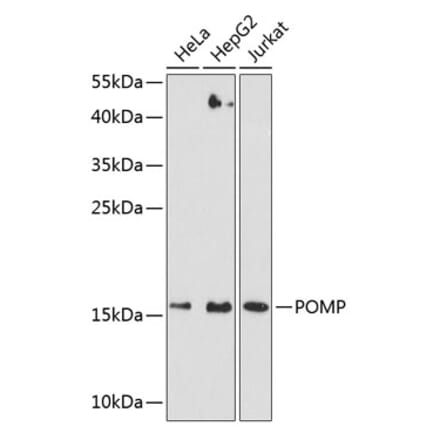 Western Blot - Anti-Proteasome maturation protein Antibody (A12335) - Antibodies.com