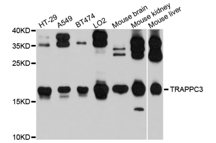 Western Blot - Anti-TRAPPC3 Antibody (A9113) - Antibodies.com