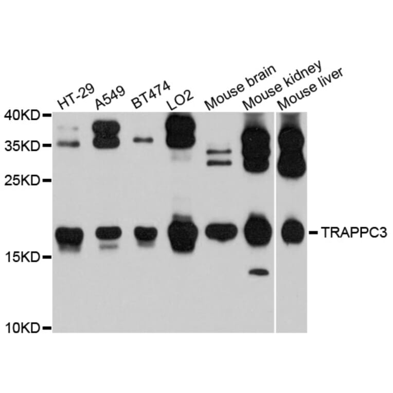 Western Blot - Anti-TRAPPC3 Antibody (A9113) - Antibodies.com