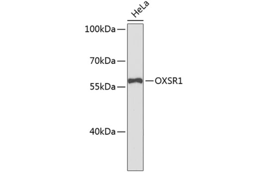 Western Blot - Anti-OXSR1 Antibody (A9117) - Antibodies.com
