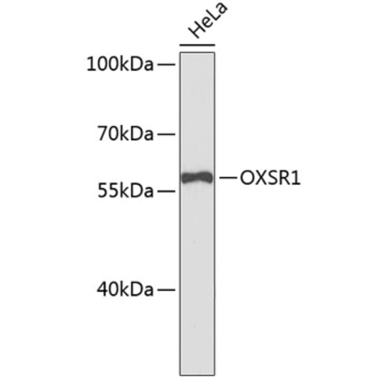 Western Blot - Anti-OXSR1 Antibody (A9117) - Antibodies.com