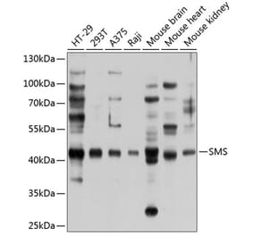 Western Blot - Anti-Spermine synthase Antibody (A12344) - Antibodies.com