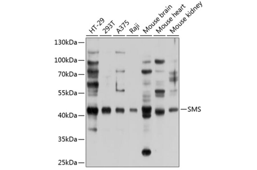 Western Blot - Anti-Spermine synthase Antibody (A12344) - Antibodies.com