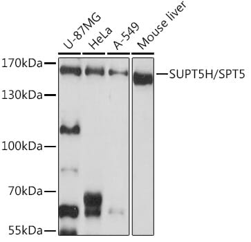 Western blot analysis of extracts of various cell lines, using Anti-SUPT5H Antibody (A9193) at 1:1,000 dilution.
Secondary antibody: Goat Anti-Rabbit IgG (H+L) (HRP) (AS014) at 1:10,000 dilution.
Lysates / proteins: 25µg per lane.
Blocking buffer: 3% non-fat dry milk in TBST.
Detection: ECL Basic Kit (RM00020).
Exposure time: 10s.