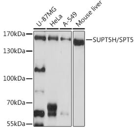 Western Blot - Anti-SPT5 Antibody (A12346) - Antibodies.com
