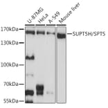 Western Blot - Anti-SPT5 Antibody (A12346) - Antibodies.com
