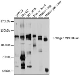 Western Blot - Anti-Collagen VI Antibody (A12348) - Antibodies.com