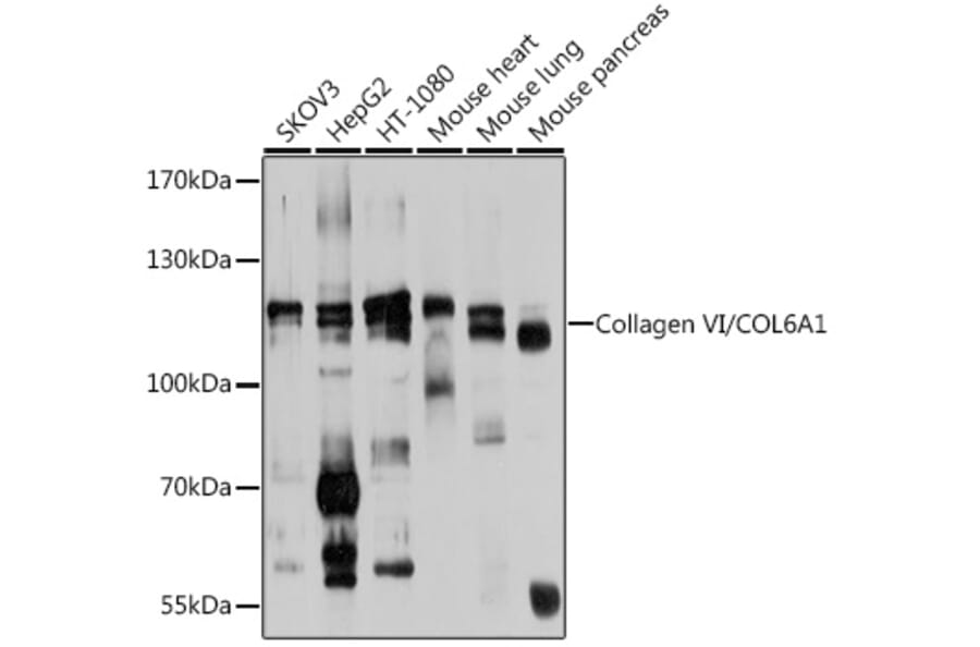 Western Blot - Anti-Collagen VI Antibody (A12348) - Antibodies.com