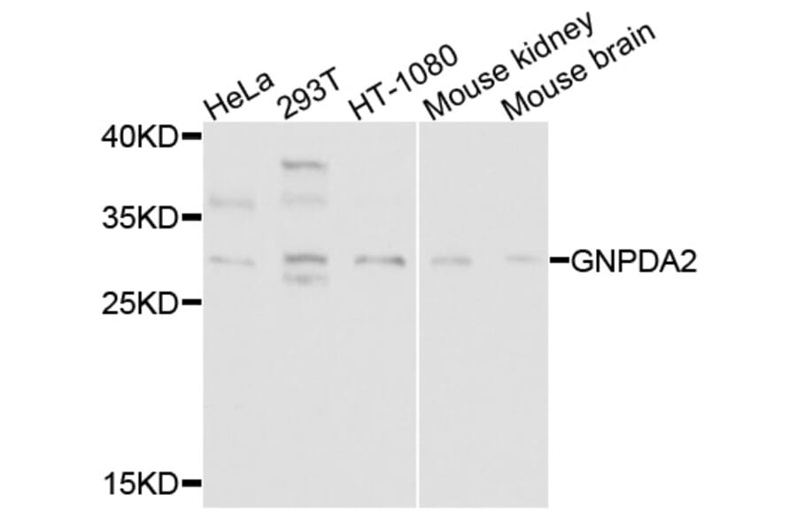 Western Blot - Anti-GNPDA2 Antibody (A9245) - Antibodies.com