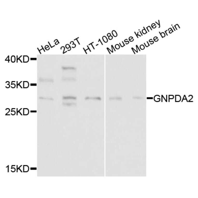 Western Blot - Anti-GNPDA2 Antibody (A9245) - Antibodies.com