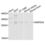 Western Blot - Anti-GNPDA2 Antibody (A9245) - Antibodies.com