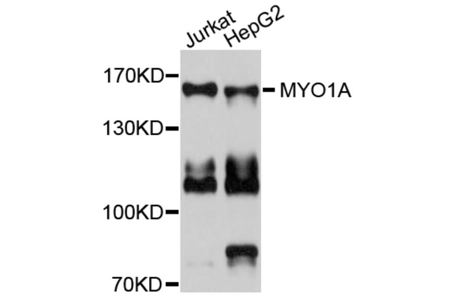 Western Blot - Anti-MYO1A Antibody (A9272) - Antibodies.com