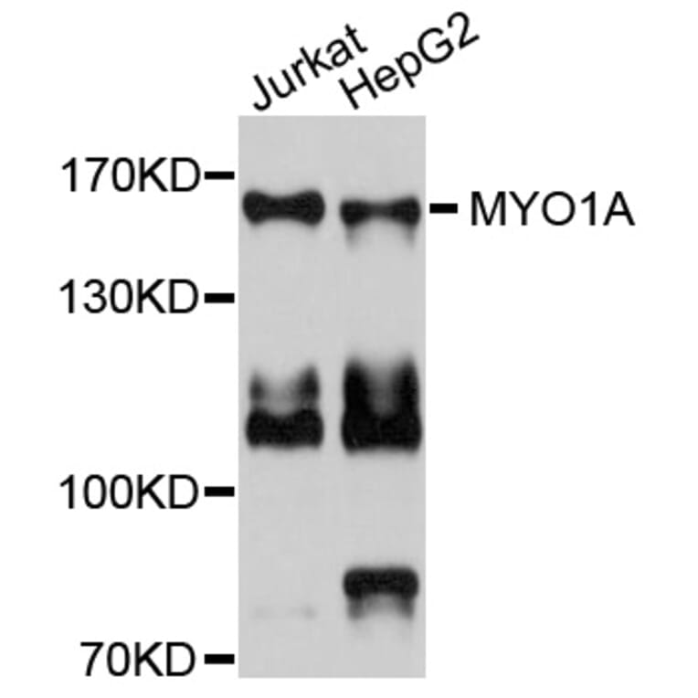 Western Blot - Anti-MYO1A Antibody (A9272) - Antibodies.com