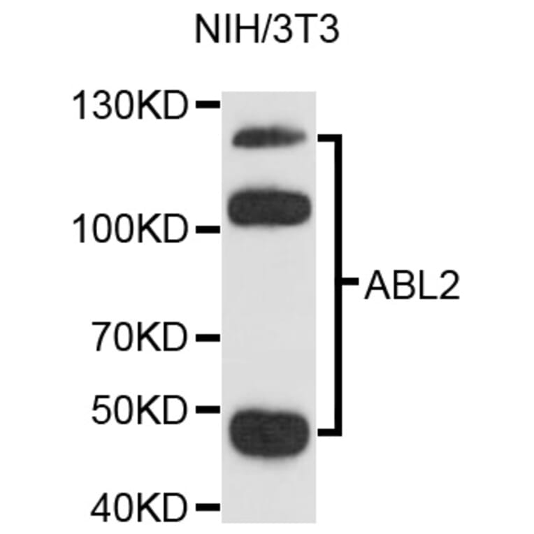 Western Blot - Anti-ABL2 Antibody (A9289) - Antibodies.com