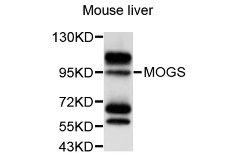 Western Blot - Anti-MOGS Antibody (A9313) - Antibodies.com