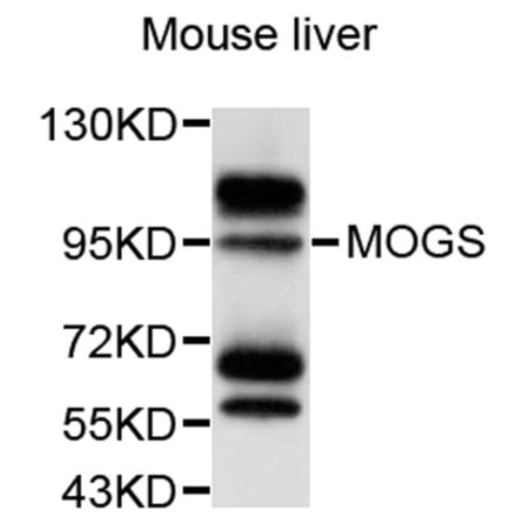 Western Blot - Anti-MOGS Antibody (A9313) - Antibodies.com
