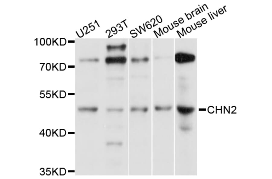 Western Blot - Anti-CHN2 Antibody (A9343) - Antibodies.com